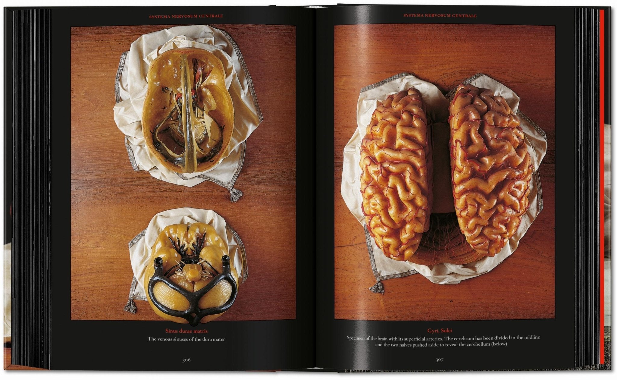 Anatomical Waxes. 45th Ed. (German, French, English) - POPvault