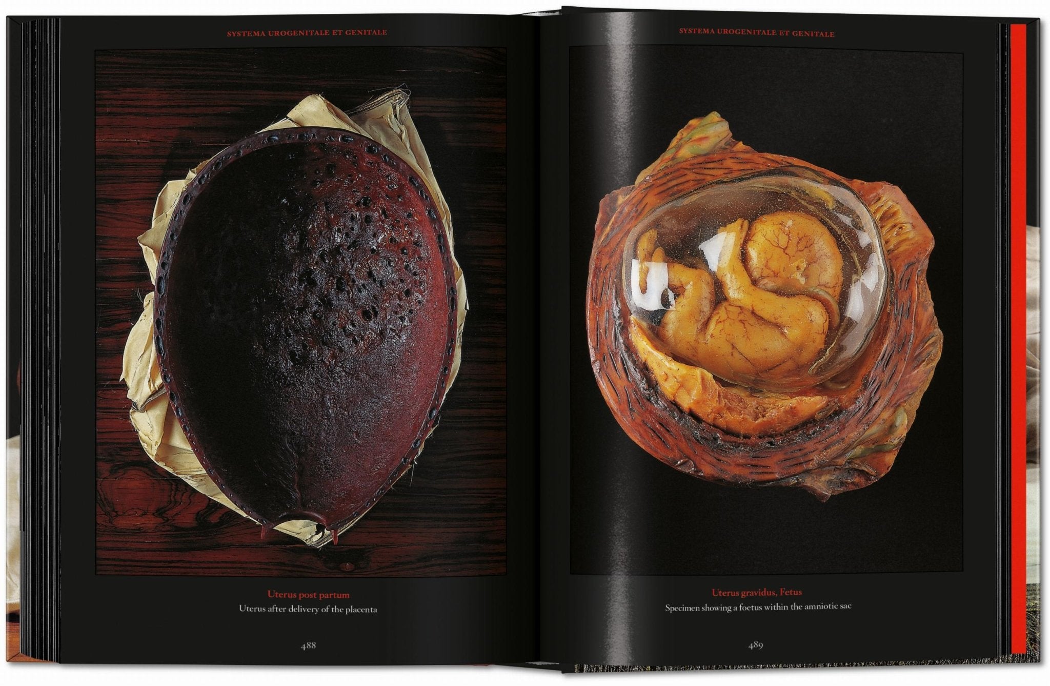 Anatomical Waxes. 45th Ed. (German, French, English) - POPvault