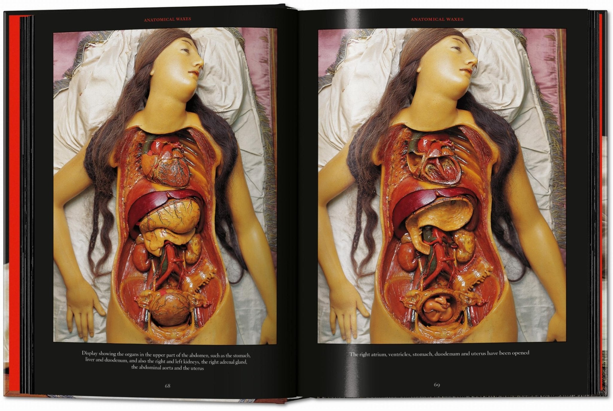 Anatomical Waxes. 45th Ed. (German, French, English) - POPvault